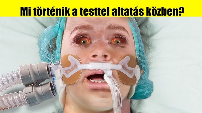 Mi történik a testtel érzéstelenítés és altatás közben? Amit a legtöbb beteg nem tud!