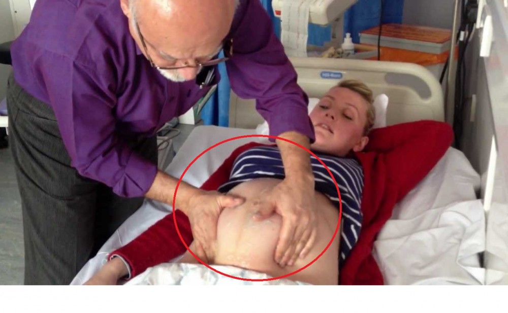 Az orvos megfordítja a harántfekvésű babát kézzel. De aztán nézzék meg a kismama hasát.